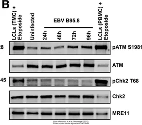 Anti-ATM antibody [2C1] used in Western Blot (WB). GTX70103
