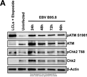 Anti-ATM antibody [2C1] used in Western Blot (WB). GTX70103