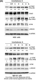 Anti-ATM antibody [2C1] used in Western Blot (WB). GTX70103