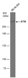 Anti-ATM antibody [2C1] used in Western Blot (WB). GTX70103