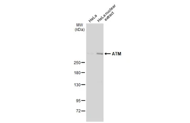 Anti-ATM antibody [2C1] used in Western Blot (WB). GTX70103