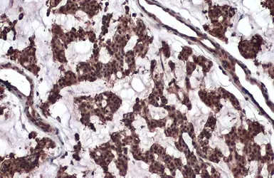 Anti-ATM antibody [2C1] used in IHC (Paraffin sections) (IHC-P). GTX70103