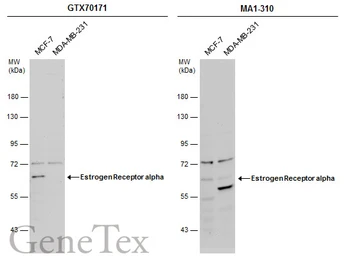 Anti-Estrogen Receptor alpha antibody [1F3] used in Western Blot (WB). GTX70171