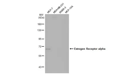 Anti-Estrogen Receptor alpha antibody [1F3] used in Western Blot (WB). GTX70171