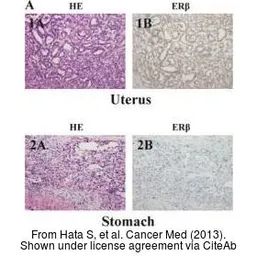 Anti-Estrogen Receptor beta antibody [14C8] used in IHC (Paraffin sections) (IHC-P). GTX70174