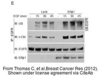Anti-Estrogen Receptor beta antibody [14C8] used in Western Blot (WB). GTX70174