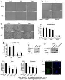 Anti-Estrogen Receptor beta antibody [14C8] used in Western Blot (WB). GTX70174