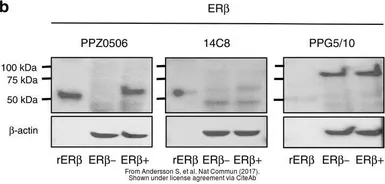 Anti-Estrogen Receptor beta antibody [14C8] used in Western Blot (WB). GTX70174
