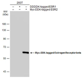 Anti-Estrogen Receptor beta antibody [14C8] used in Western Blot (WB). GTX70174