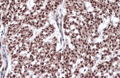 Anti-Estrogen Receptor beta antibody [14C8] used in IHC (Paraffin sections) (IHC-P). GTX70174