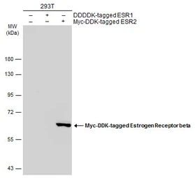 Anti-Estrogen Receptor beta antibody [6A12] used in Western Blot (WB). GTX70178