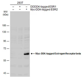 Anti-Estrogen Receptor beta antibody [6B12] used in Western Blot (WB). GTX70180