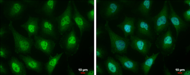 Anti-ID3 antibody [2B11] used in Immunocytochemistry/ Immunofluorescence (ICC/IF). GTX70201