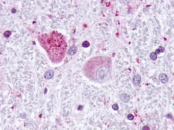 Anti-Jab1 antibody [2A10.8] used in Immunohistochemistry (IHC). GTX70203