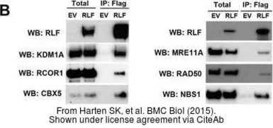 Anti-Mre11 antibody [12D7] used in Western Blot (WB). GTX70212