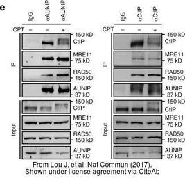 Anti-Mre11 antibody [12D7] used in Western Blot (WB). GTX70212