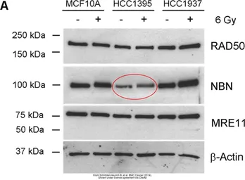 Anti-Mre11 antibody [12D7] used in Western Blot (WB). GTX70212