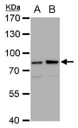 Anti-Mre11 antibody [12D7] used in Western Blot (WB). GTX70212