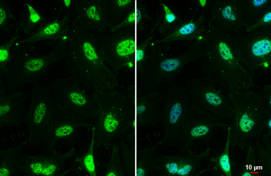 Anti-Mre11 antibody [12D7] used in Immunocytochemistry/ Immunofluorescence (ICC/IF). GTX70212