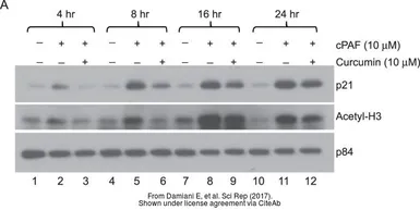 Anti-Nuclear Matrix Protein p84 antibody [5E10] used in Western Blot (WB). GTX70220