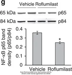 Anti-Nuclear Matrix Protein p84 antibody [5E10] used in Western Blot (WB). GTX70220