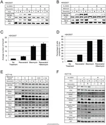 Anti-NBS1 antibody [1D7] used in Western Blot (WB). GTX70224