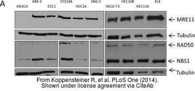 Anti-NBS1 antibody [1D7] used in Western Blot (WB). GTX70224
