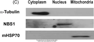 Anti-NBS1 antibody [1D7] used in Western Blot (WB). GTX70224