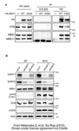 Anti-NBS1 antibody [1D7] used in Western Blot (WB). GTX70224