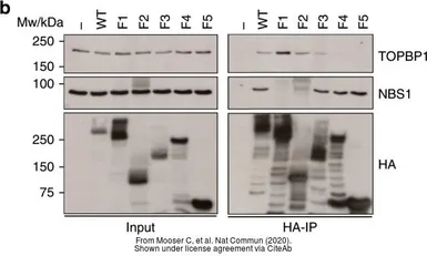 Anti-NBS1 antibody [1D7] used in Western Blot (WB). GTX70224