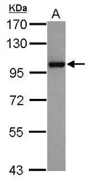 Anti-NBS1 antibody [1D7] used in Western Blot (WB). GTX70224