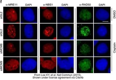 Anti-Rad50 antibody [13B3] used in Immunocytochemistry/ Immunofluorescence (ICC/IF). GTX70228
