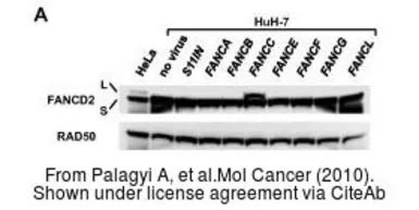 Anti-Rad50 antibody [13B3] used in Western Blot (WB). GTX70228