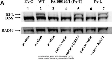 Anti-Rad50 antibody [13B3] used in Western Blot (WB). GTX70228