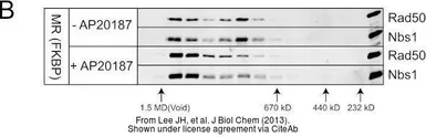 Anti-Rad50 antibody [13B3] used in Western Blot (WB). GTX70228