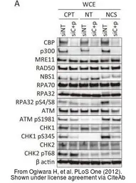 Anti-Rad50 antibody [13B3] used in Western Blot (WB). GTX70228