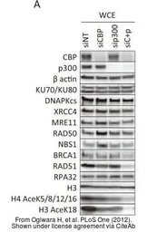 Anti-Rad50 antibody [13B3] used in Western Blot (WB). GTX70228