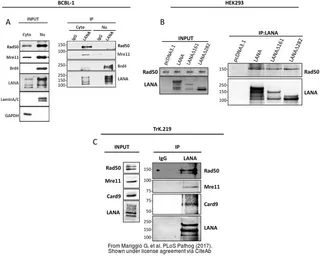Anti-Rad50 antibody [13B3] used in Western Blot (WB). GTX70228