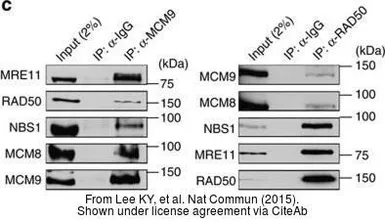 Anti-Rad50 antibody [13B3] used in Western Blot (WB). GTX70228