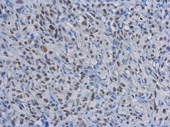 Anti-Rad50 antibody [13B3] used in IHC (Paraffin sections) (IHC-P). GTX70228