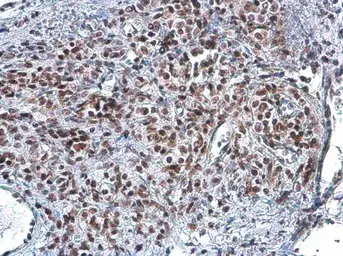 Anti-Rad50 antibody [13B3] used in IHC (Paraffin sections) (IHC-P). GTX70228