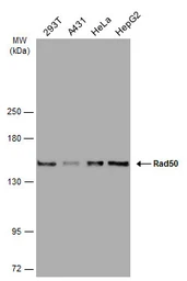 Anti-Rad50 antibody [13B3] used in Western Blot (WB). GTX70228