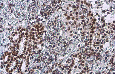 Anti-Rad50 antibody [13B3] used in IHC (Paraffin sections) (IHC-P). GTX70228
