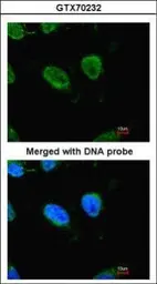 Anti-RbAp48 antibody [11G10] used in Immunocytochemistry/ Immunofluorescence (ICC/IF). GTX70232