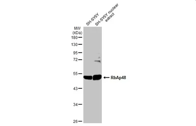 Anti-RbAp48 antibody [13D10] used in Western Blot (WB). GTX70234