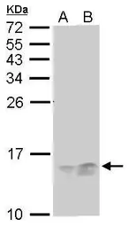 Anti-RPA14 antibody [11.1] used in Western Blot (WB). GTX70238