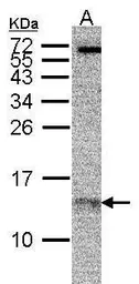 Anti-RPA14 antibody [11.1] used in Western Blot (WB). GTX70238