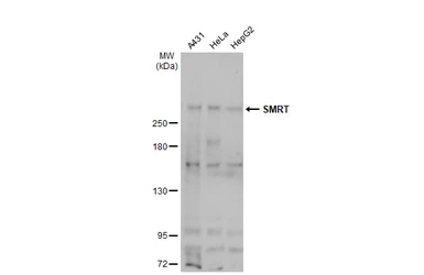 Anti-SMRT antibody used in Western Blot (WB). GTX70245