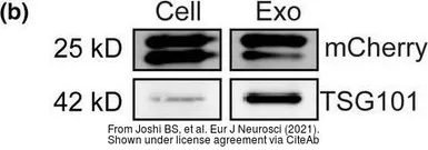 Anti-TSG101 antibody [4A10] used in Western Blot (WB). GTX70255
