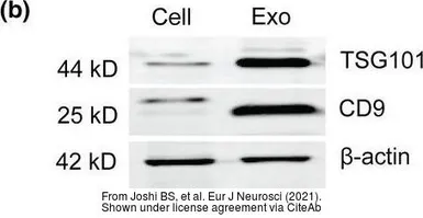 Anti-TSG101 antibody [4A10] used in Western Blot (WB). GTX70255